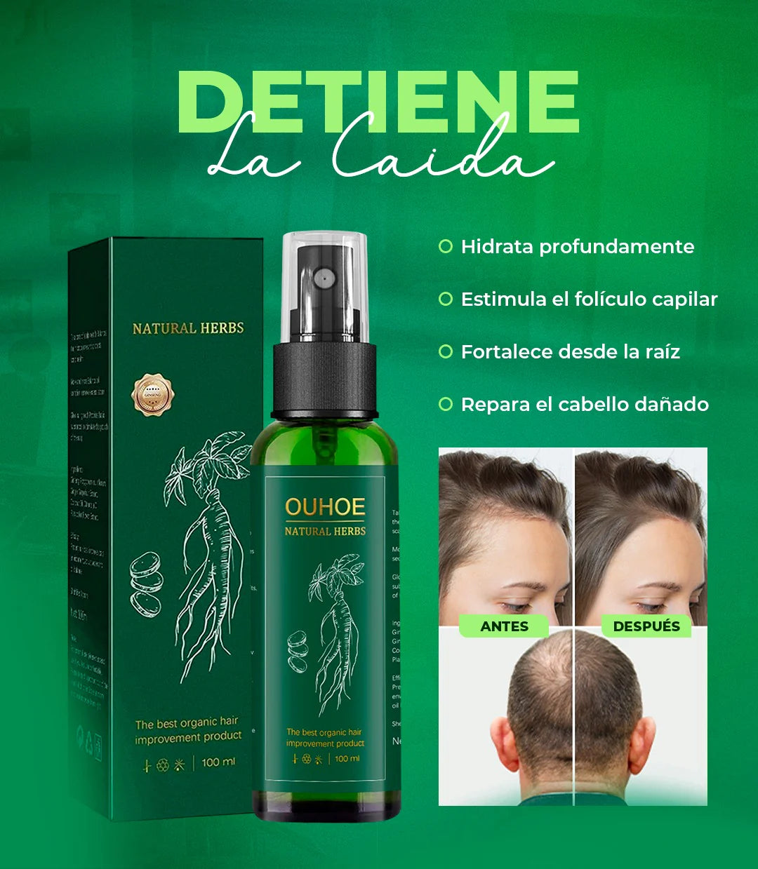 LOCION CAPILAR ANTICAIDA - Nutre y fortalece el cabello + Envio Gratis 🎁